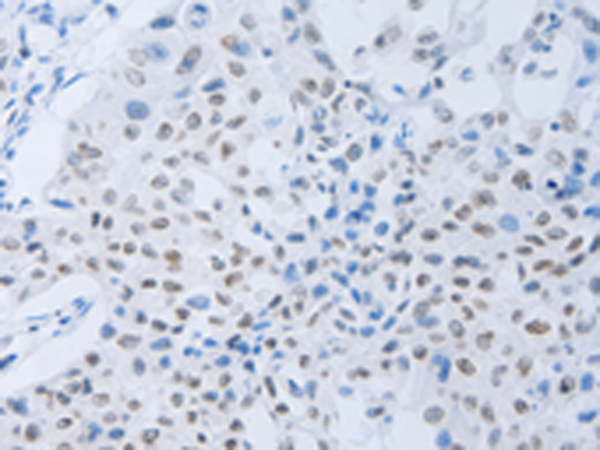 Rabbit Polyclonal Antibody to CSF1R
