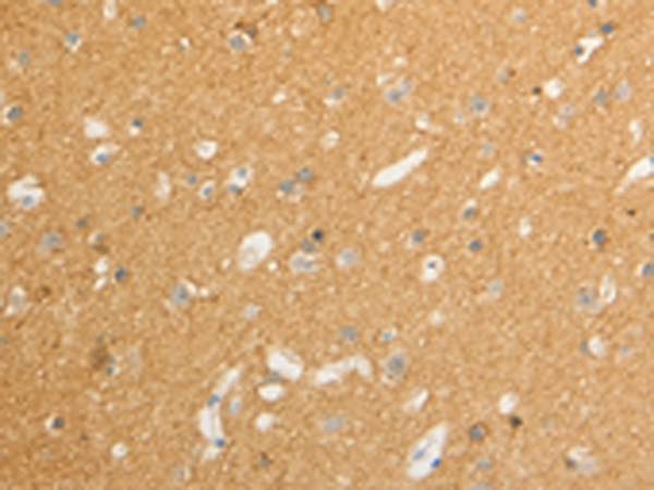 Rabbit Polyclonal Antibody to ATP1A1