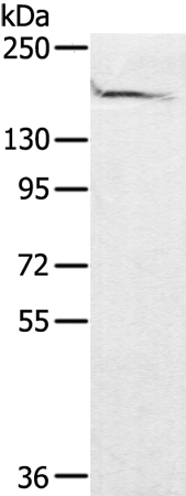 Rabbit Polyclonal Antibody to ABCC1