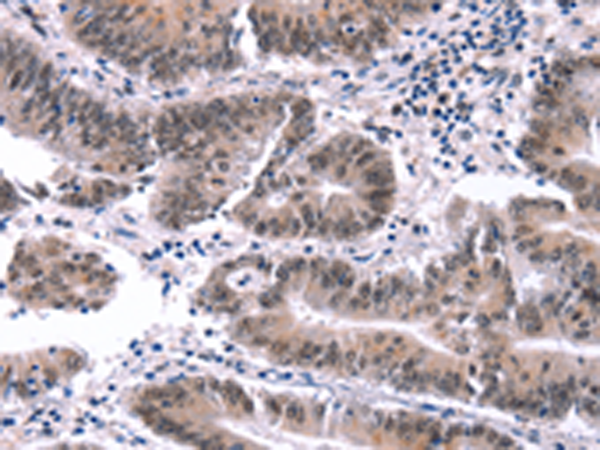 Rabbit Polyclonal Antibody to MYF5