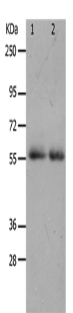 Rabbit Polyclonal Antibody to MMP17