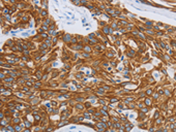 Rabbit Polyclonal Antibody to MMP21