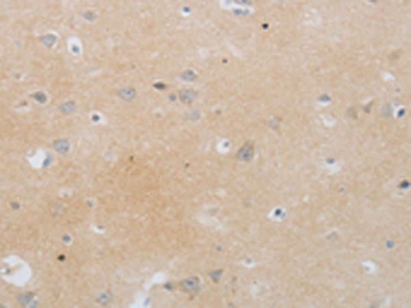 Rabbit Polyclonal Antibody to MMP25
