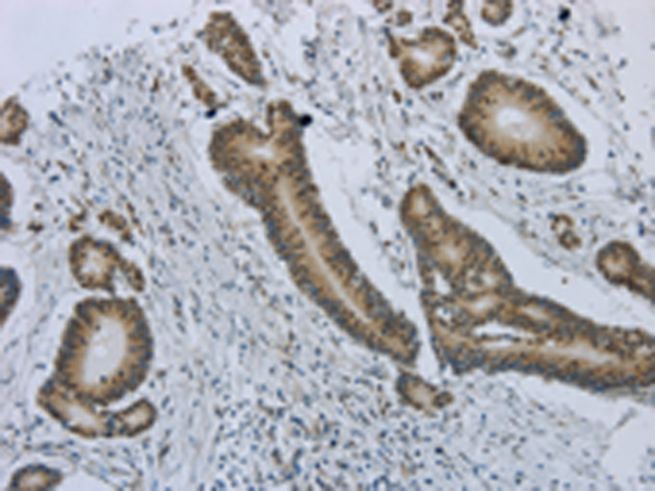 Rabbit Polyclonal Antibody to MMP24