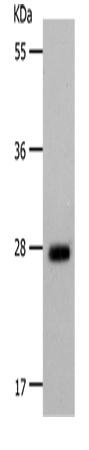 Rabbit Polyclonal Antibody to POMC(Alpha-MSH)