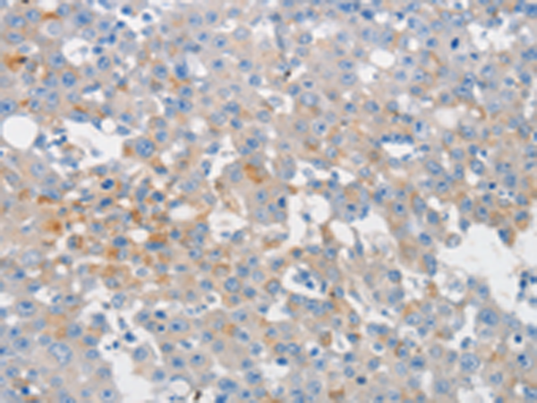 Rabbit Polyclonal Antibody to MUC5AC