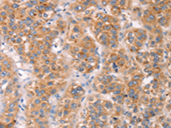 Rabbit Polyclonal Antibody to MLNR