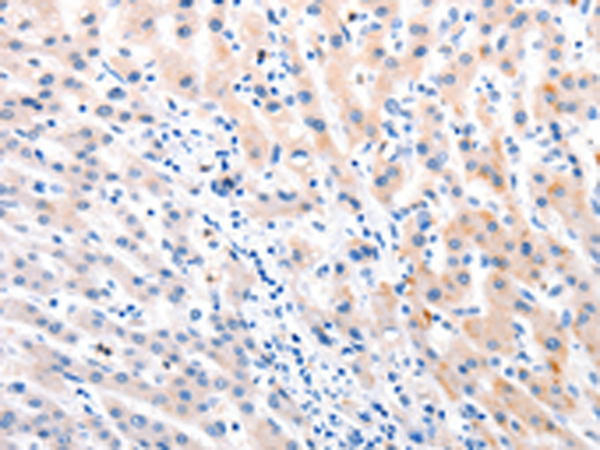 Rabbit Polyclonal Antibody to MTOR