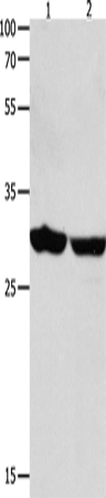 Rabbit Polyclonal Antibody to YWHAE