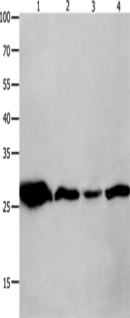 Rabbit Polyclonal Antibody to YWHAQ