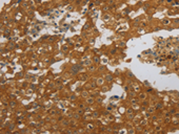 Rabbit Polyclonal Antibody to NBN
