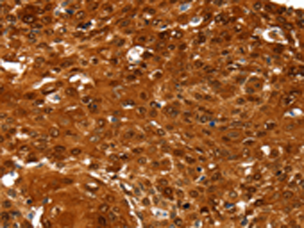 Rabbit Polyclonal Antibody to NCOR1