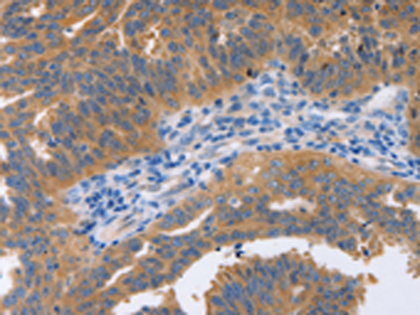 Rabbit Polyclonal Antibody to NBEA