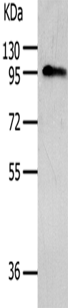 Rabbit Polyclonal Antibody to AKAP8
