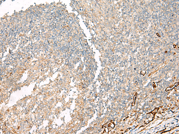 Rabbit Polyclonal Antibody to NFASC