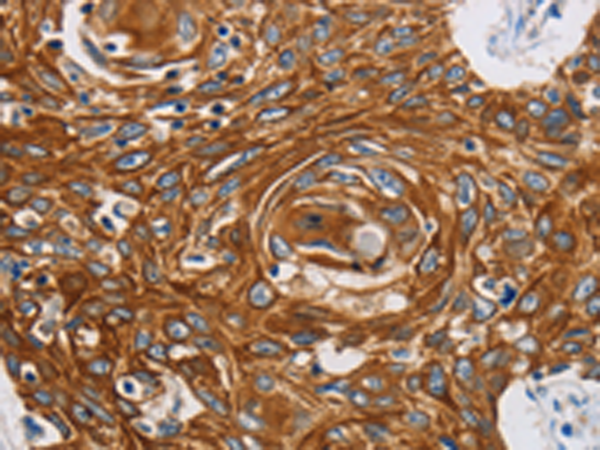 Rabbit Polyclonal Antibody to GRIN1
