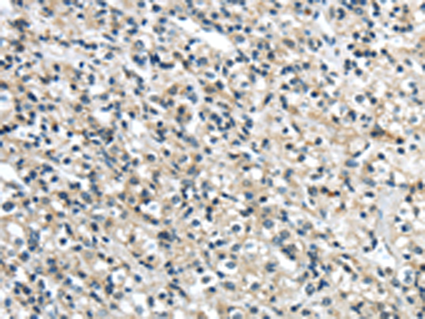 Rabbit Polyclonal Antibody to GRIN2A
