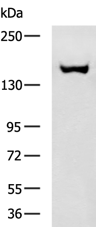 Rabbit Polyclonal Antibody to GRIN2B