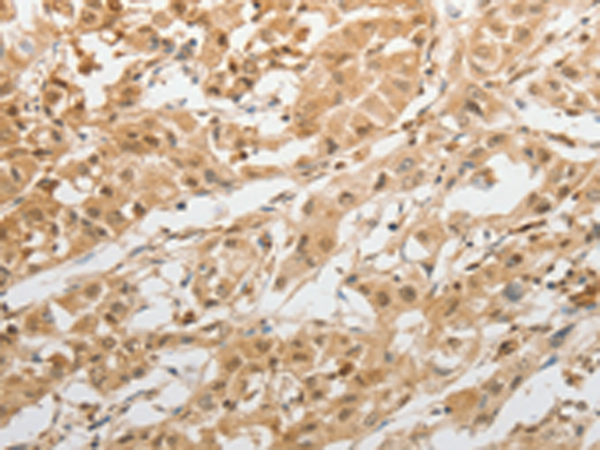 Rabbit Polyclonal Antibody to GRIN2C