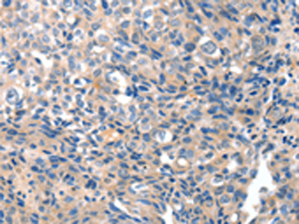 Rabbit Polyclonal Antibody to GRIN2D