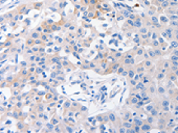 Rabbit Polyclonal Antibody to SLC10A1
