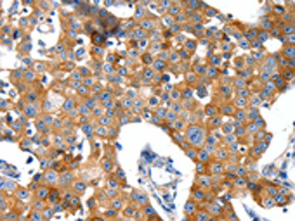 Rabbit Polyclonal Antibody to GRIA2