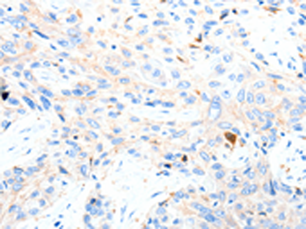 Rabbit Polyclonal Antibody to P2RY1