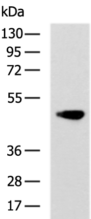 Rabbit Polyclonal Antibody to P2RY11