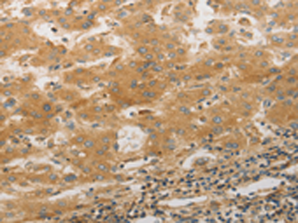 Rabbit Polyclonal Antibody to PLPP1