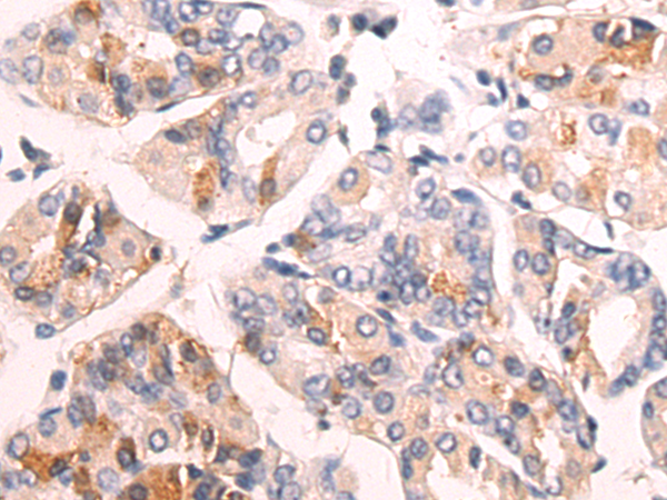 Rabbit Polyclonal Antibody to F2R