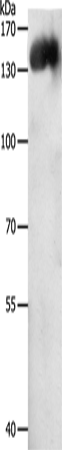 Rabbit Polyclonal Antibody to PECAM1