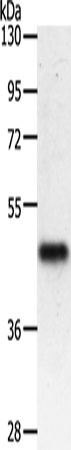 Rabbit Polyclonal Antibody to PDK2