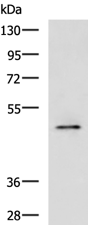 Rabbit Polyclonal Antibody to PDK4