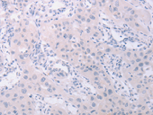 Rabbit Polyclonal Antibody to PKD2L1