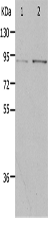 Rabbit Polyclonal Antibody to PIBF1