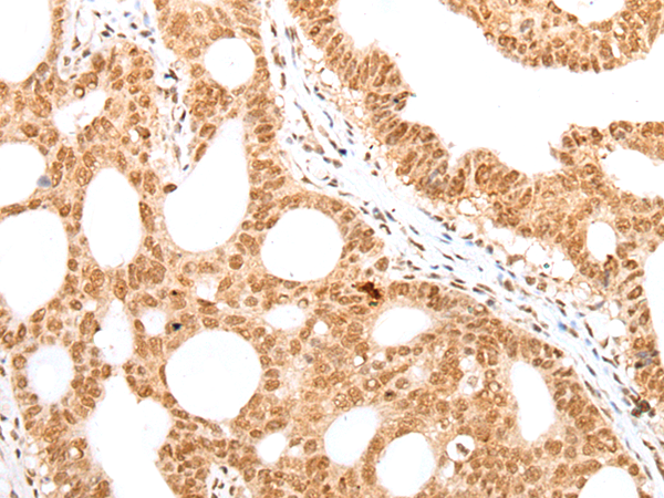 Rabbit Polyclonal Antibody to CARM1/PRMT4