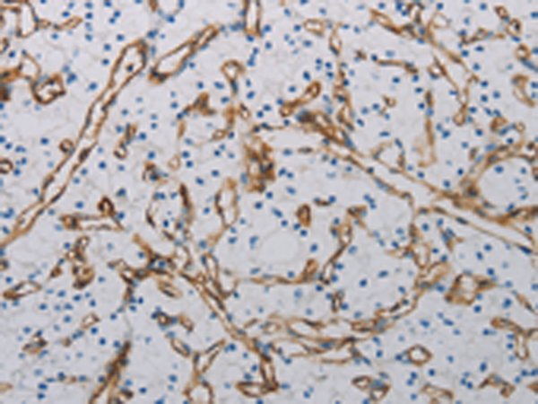 Rabbit Polyclonal Antibody to PECAM1
