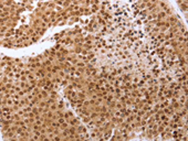 Rabbit Polyclonal Antibody to PTTG1