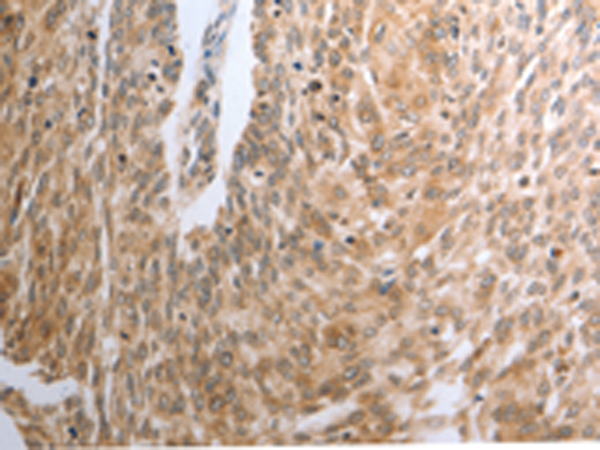 Rabbit Polyclonal Antibody to RAD51