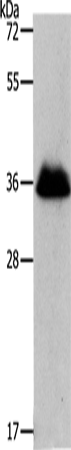 Rabbit Polyclonal Antibody to RNF126