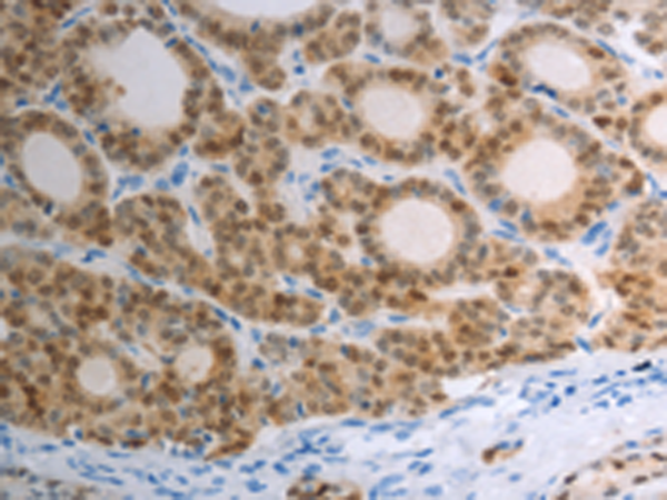 Rabbit Polyclonal Antibody to S100A1