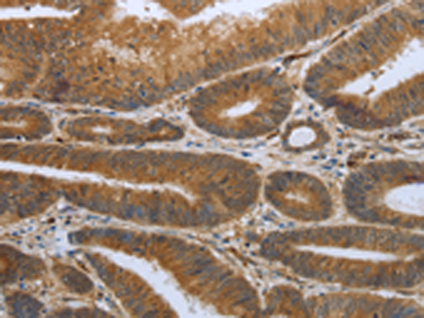 Rabbit Polyclonal Antibody to SHBG