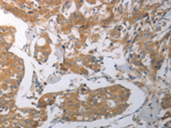 Rabbit Polyclonal Antibody to SHH