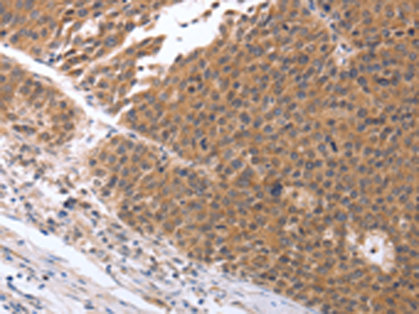 Rabbit Polyclonal Antibody to GEMIN2