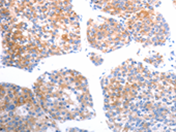 Rabbit Polyclonal Antibody to SLC44A1