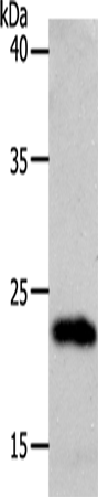 Rabbit Polyclonal Antibody to SOCS1