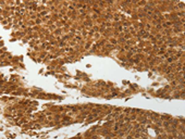 Rabbit Polyclonal Antibody to SOCS7