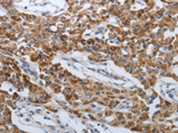 Rabbit Polyclonal Antibody to SPAG1