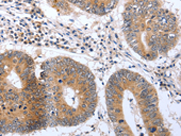 Rabbit Polyclonal Antibody to PSPN