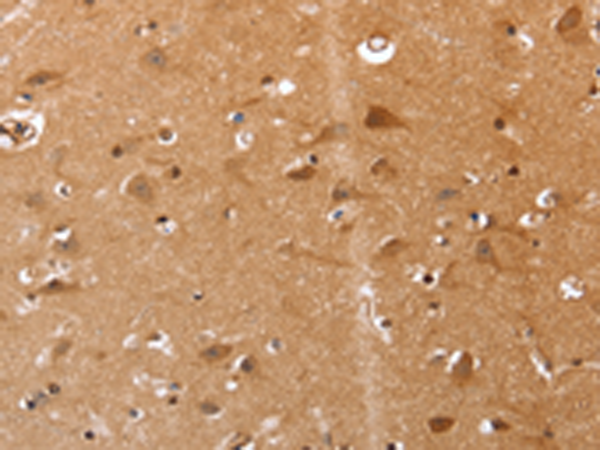 Rabbit Polyclonal Antibody to SELENOS